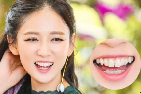 铁岭的明星网红,揭秘东北明星网红的崛起之路