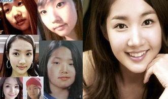 整容后明星网红